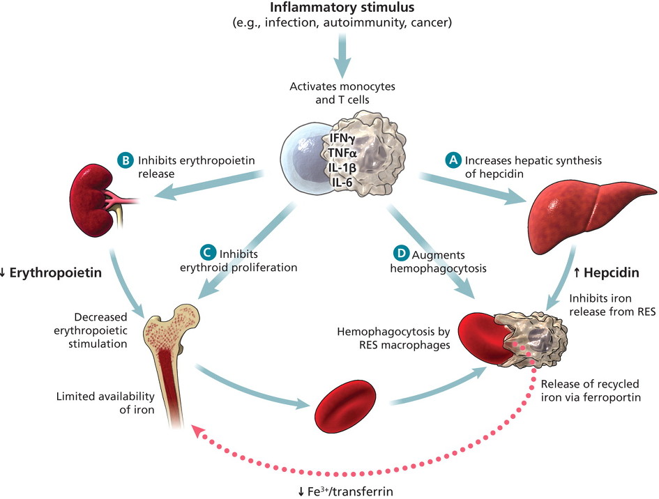 chronic-disease-risk-goes-way-up-with-just-14-days-of-inactivity